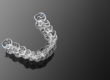 example of clear aligners