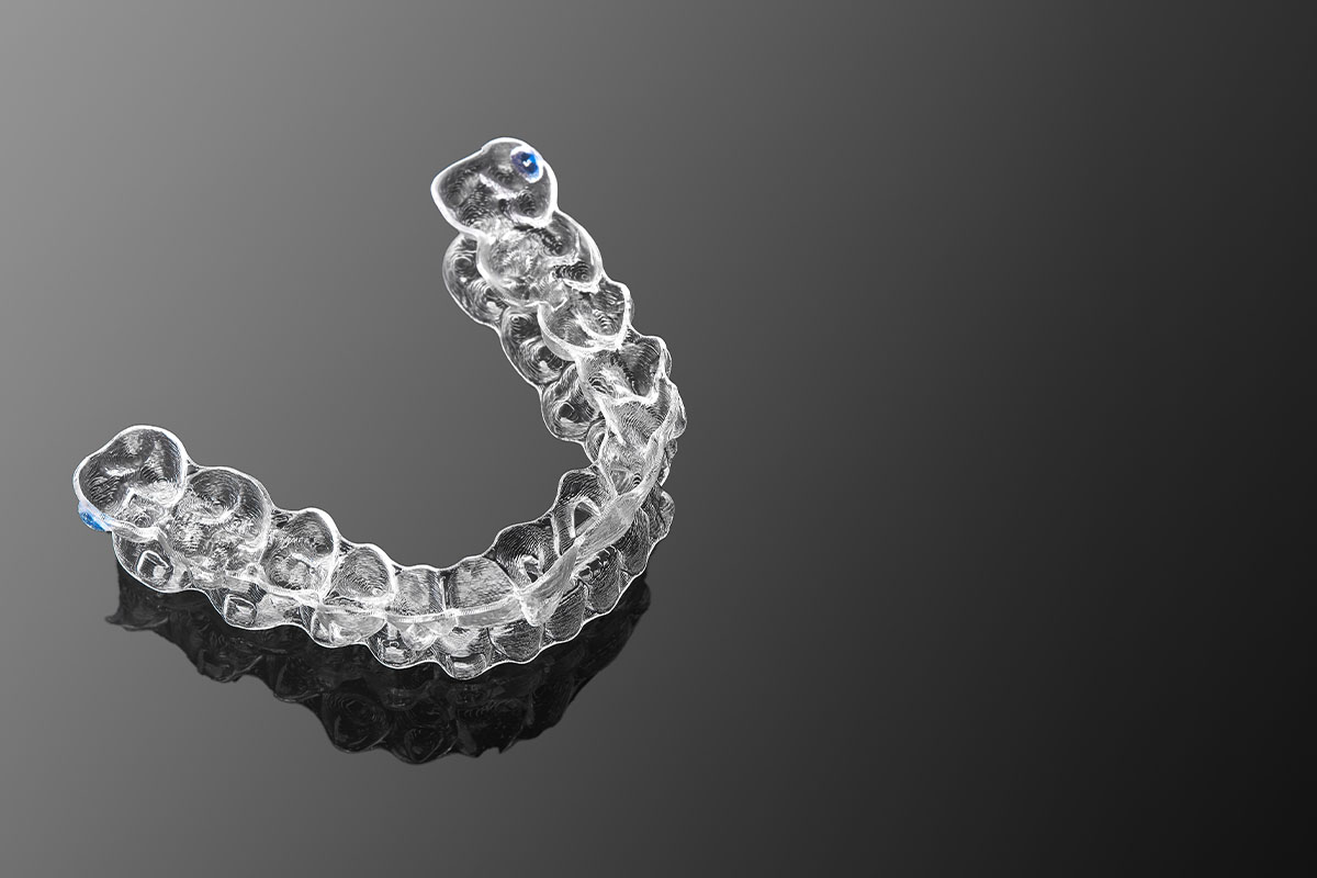 example of clear aligners