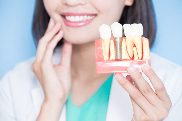 full mouth dental implants texas woman smiling holding model of full mouth dental implants texas
