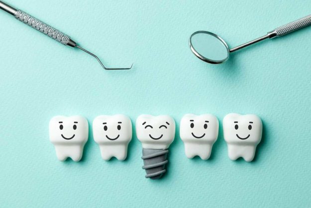 4-Benefits-of-Dental-Implants example of a dental implant