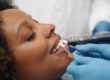 woman gets dental veneers