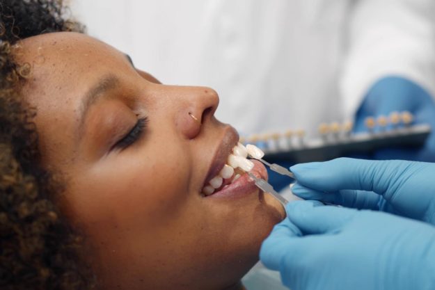 5 Benefits of Dental Veneers (1) woman gets dental veneers