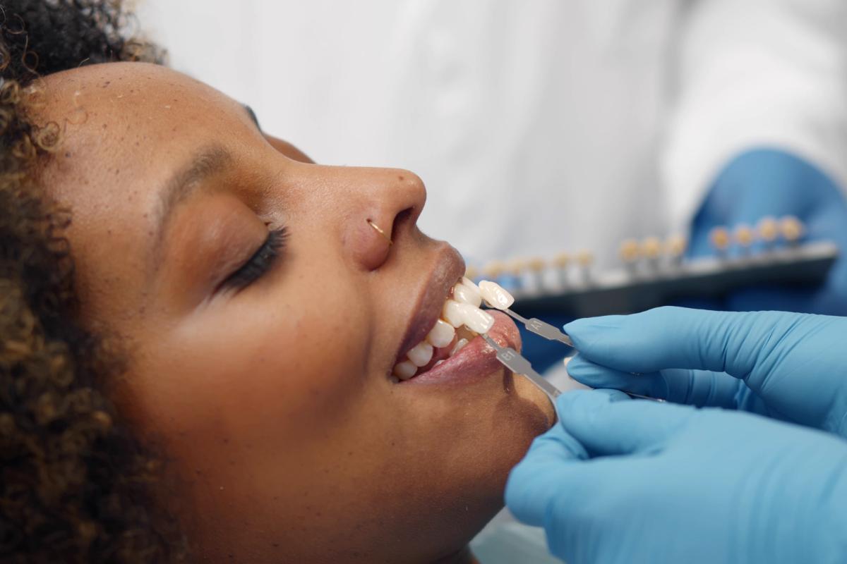 woman gets dental veneers