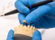 example of dental implants