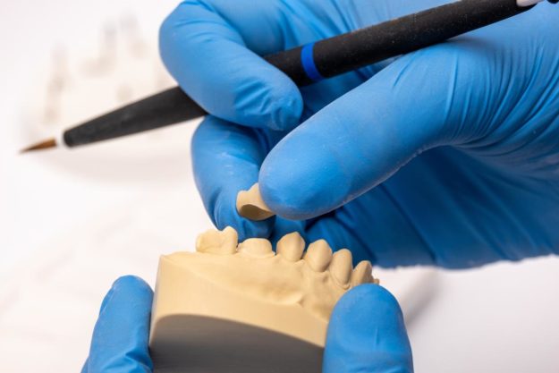 How Do Dental Implants Work (2) example of dental implants